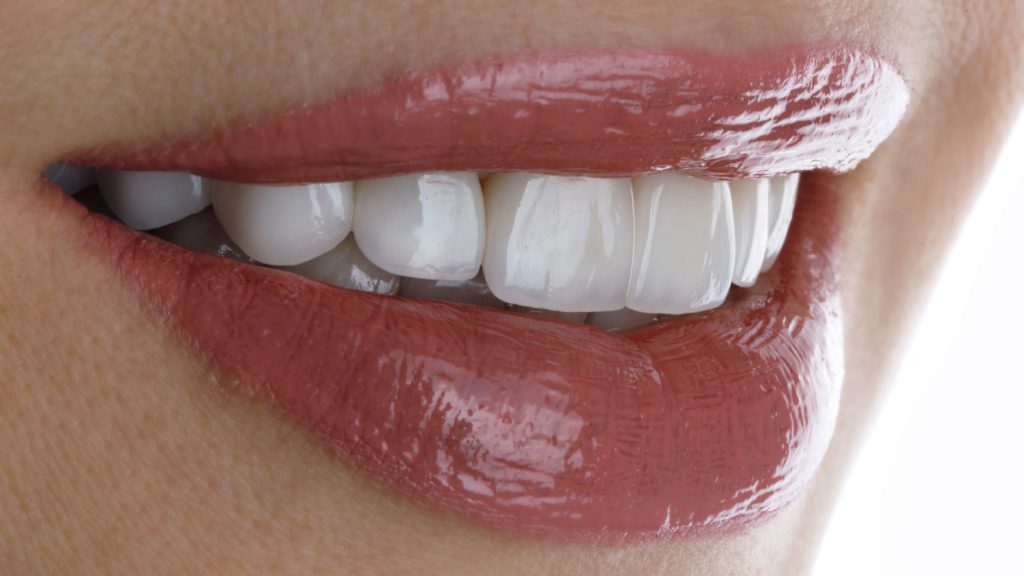woman smiling with beautiful porcelain veneers she got from 21st century dentistry in Nashville